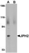 Junctophilin 4 antibody, A13608, Boster Biological Technology, Western Blot image 