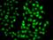 Proteasome 26S Subunit, Non-ATPase 8 antibody, orb247706, Biorbyt, Immunocytochemistry image 