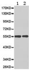 H/ACA ribonucleoprotein complex subunit 4 antibody, TA323896, Origene, Western Blot image 