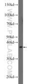 1-Acylglycerol-3-Phosphate O-Acyltransferase 3 antibody, 25723-1-AP, Proteintech Group, Western Blot image 