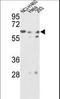 Glucosamine (N-Acetyl)-6-Sulfatase antibody, LS-C166573, Lifespan Biosciences, Western Blot image 