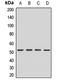 Fatty acid desaturase 2 antibody, LS-C668519, Lifespan Biosciences, Western Blot image 