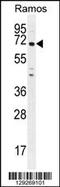 PARN Like, Ribonuclease Domain Containing 1 antibody, 55-815, ProSci, Western Blot image 