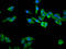 Ribosomal Protein S23 antibody, LS-C681231, Lifespan Biosciences, Immunofluorescence image 