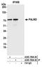 Palmdelphin antibody, A305-789A-M, Bethyl Labs, Immunoprecipitation image 