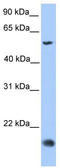 CKLF Like MARVEL Transmembrane Domain Containing 8 antibody, TA337583, Origene, Western Blot image 