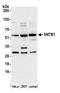 Syntrophin Beta 1 antibody, A305-503A, Bethyl Labs, Western Blot image 