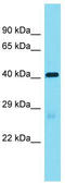 Leucine Rich Repeat Containing 19 antibody, TA338626, Origene, Western Blot image 