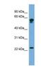 D-Aminoacyl-TRNA Deacylase 2 antibody, NBP1-79499, Novus Biologicals, Western Blot image 