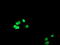 Methyltransferase Like 16 antibody, TA504728, Origene, Immunofluorescence image 