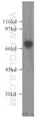 PBC antibody, 13426-1-AP, Proteintech Group, Western Blot image 