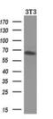 Beta-Transducin Repeat Containing E3 Ubiquitin Protein Ligase antibody, M01747, Boster Biological Technology, Western Blot image 