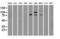 B-Raf Proto-Oncogene, Serine/Threonine Kinase antibody, LS-C784269, Lifespan Biosciences, Western Blot image 