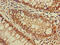 DnaJ Heat Shock Protein Family (Hsp40) Member C4 antibody, CSB-PA865087LA01HU, Cusabio, Immunohistochemistry paraffin image 