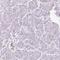 Stromal Cell Derived Factor 4 antibody, HPA011249, Atlas Antibodies, Immunohistochemistry paraffin image 