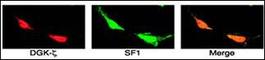 Diacylglycerol Kinase Zeta antibody, NBP2-29920, Novus Biologicals, Immunofluorescence image 