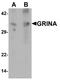 Glutamate Ionotropic Receptor NMDA Type Subunit Associated Protein 1 antibody, A11283, Boster Biological Technology, Western Blot image 