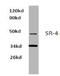 5-Hydroxytryptamine Receptor 4 antibody, AP20472PU-N, Origene, Western Blot image 