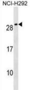 Cripto, FRL-1, Cryptic Family 1B antibody, abx025040, Abbexa, Western Blot image 
