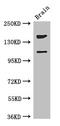 Phosphatidylinositol 3,4,5-trisphosphate-dependent Rac exchanger 2 protein antibody, CSB-PA741122LA01HU, Cusabio, Western Blot image 