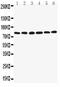 Lipoma-preferred partner antibody, GTX12294, GeneTex, Western Blot image 