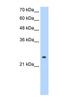 Alcohol Dehydrogenase 6 (Class V) antibody, NBP1-56345, Novus Biologicals, Western Blot image 