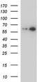 Delta-1-pyrroline-5-carboxylate dehydrogenase, mitochondrial antibody, TA590378, Origene, Western Blot image 