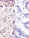 Fibroblast growth factor 10 antibody, orb10654, Biorbyt, Immunohistochemistry paraffin image 