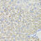 Hydroxysteroid 17-Beta Dehydrogenase 13 antibody, 22-087, ProSci, Immunohistochemistry frozen image 