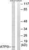 ATP synthase subunit e, mitochondrial antibody, TA313491, Origene, Western Blot image 