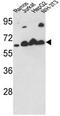 Calreticulin antibody, AP17172PU-N, Origene, Western Blot image 