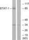 Signal Transducer And Activator Of Transcription 1 antibody, LS-C118249, Lifespan Biosciences, Western Blot image 