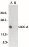 Leucine Rich Repeat Transmembrane Neuronal 2 antibody, orb95591, Biorbyt, Western Blot image 