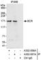 Renal carcinoma antigen NY-REN-26 antibody, A302-056A, Bethyl Labs, Immunoprecipitation image 