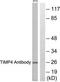 TIMP Metallopeptidase Inhibitor 4 antibody, TA311670, Origene, Western Blot image 