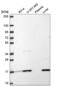 Ribosomal Protein L31 antibody, NBP2-58847, Novus Biologicals, Western Blot image 