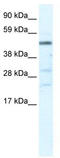 Heat Shock Transcription Factor Y-Linked 2 antibody, TA341428, Origene, Western Blot image 