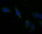 TNF Receptor Superfamily Member 11b antibody, NBP2-76904, Novus Biologicals, Immunocytochemistry image 