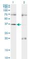 Paired box protein Pax-9 antibody, H00005083-M13, Novus Biologicals, Western Blot image 
