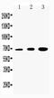 DRD2 antibody, PA2234, Boster Biological Technology, Western Blot image 