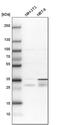 PTC7 Protein Phosphatase Homolog antibody, PA5-58741, Invitrogen Antibodies, Western Blot image 