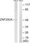 Zinc Finger Protein 280A antibody, PA5-39486, Invitrogen Antibodies, Western Blot image 