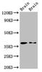 Peroxisomal Biogenesis Factor 10 antibody, LS-C673579, Lifespan Biosciences, Western Blot image 