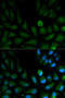 Capping Actin Protein Of Muscle Z-Line Subunit Alpha 2 antibody, STJ22888, St John