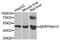 Serpin Family A Member 10 antibody, A7106, ABclonal Technology, Western Blot image 