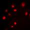 Splicing Factor 1 antibody, orb393160, Biorbyt, Immunofluorescence image 