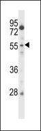 Cysteine And Serine Rich Nuclear Protein 2 antibody, LS-C167095, Lifespan Biosciences, Western Blot image 