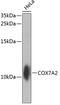 Cytochrome C Oxidase Subunit 7A2 antibody, GTX64639, GeneTex, Western Blot image 