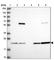 Proteasome Subunit Beta 8 antibody, HPA046995, Atlas Antibodies, Western Blot image 