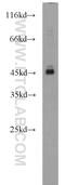 Absent In Melanoma 2 antibody, 20590-1-AP, Proteintech Group, Western Blot image 